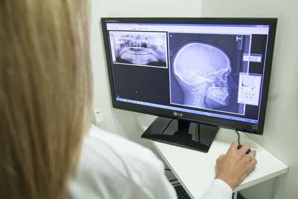 Teleradiologia - czym jest, jak działa i jakie ma zalety